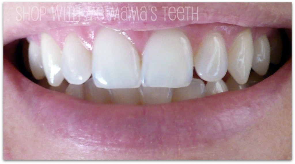 my teeth