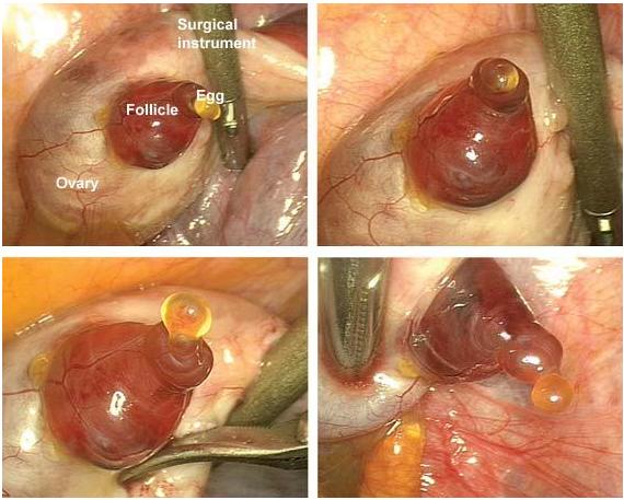 Ovulation Takes Place On Camera! Trying to Conceive And More!