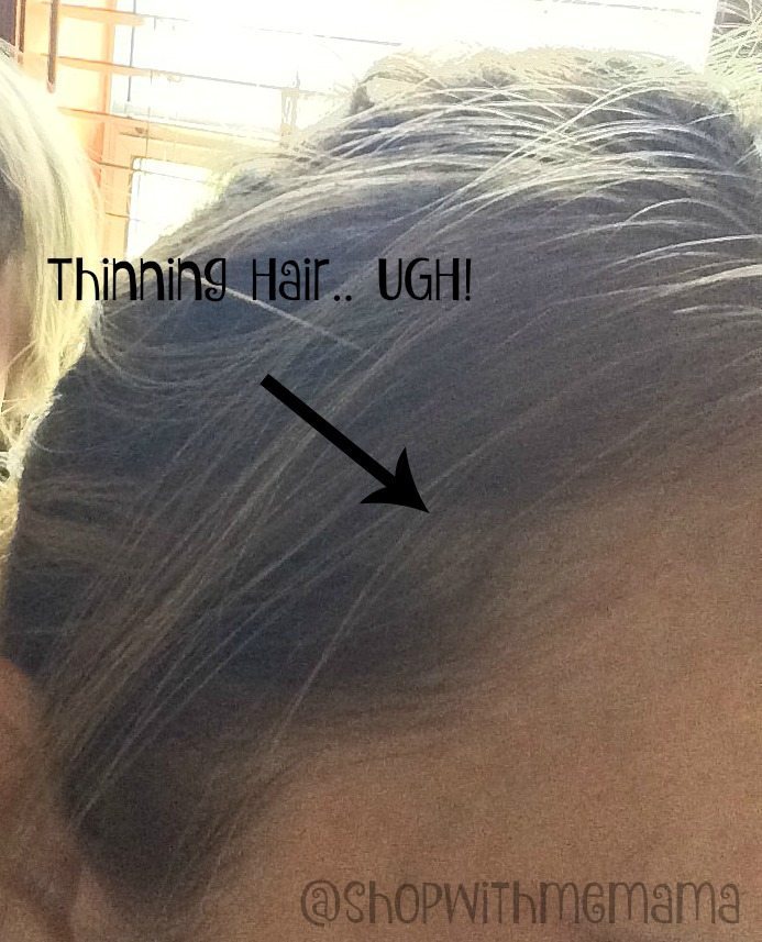 Why is my hair thinning?