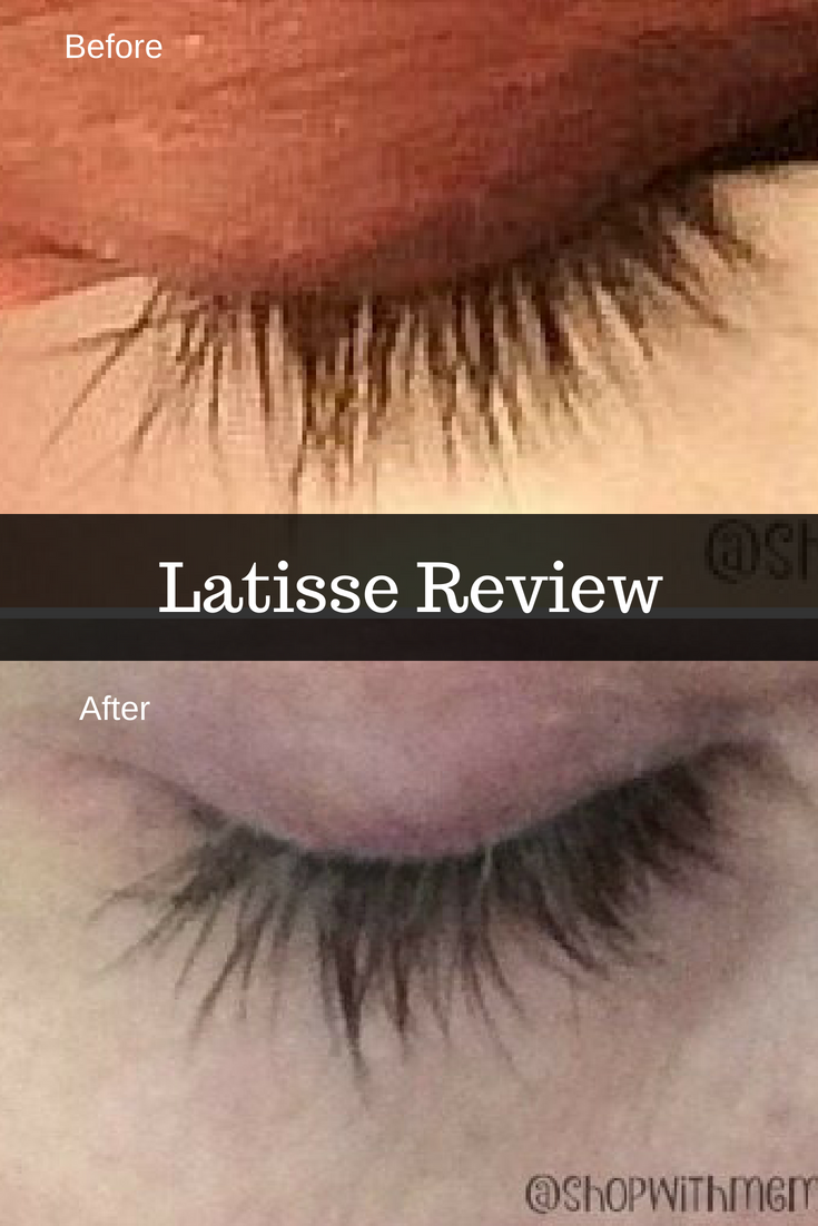 Latisse Is Worth It