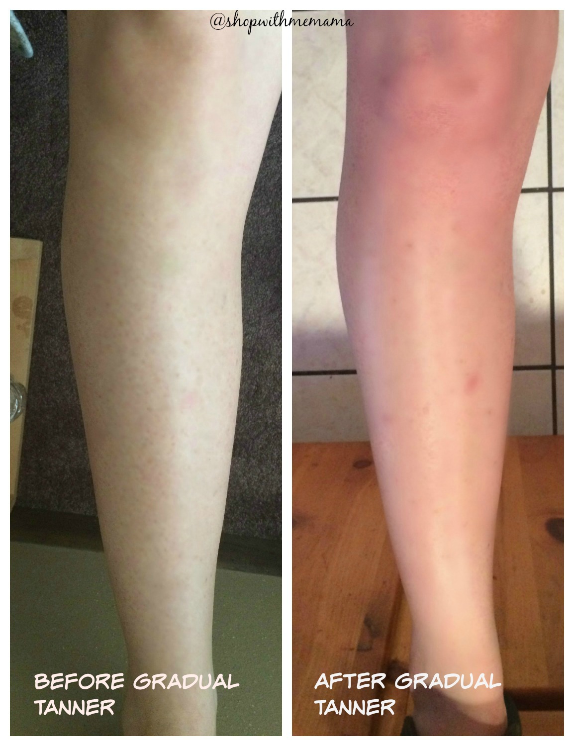 Surprising Effects of Cellulite Before And After Tanning