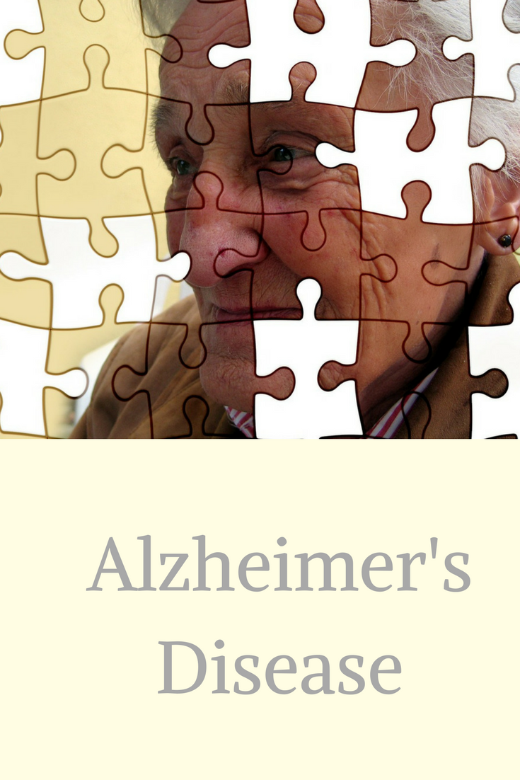 Does Aricept Donepezil Cope with the Treatment of Alzheimer's Disease?