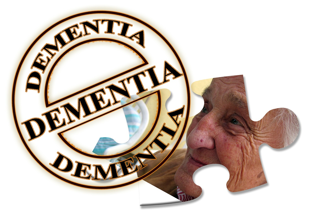 Does Aricept Donepezil Cope with the Treatment of Alzheimer's Disease?