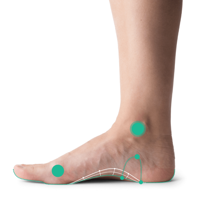 Custom Insoles For Achy Feet