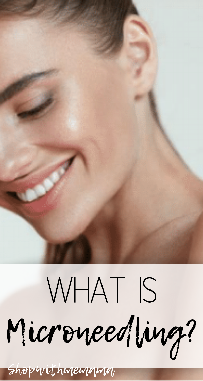 What Is Microneedling