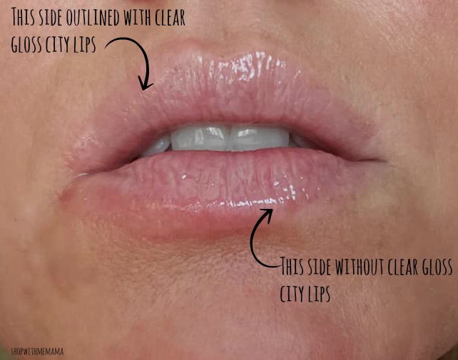 before and after pics of city lips