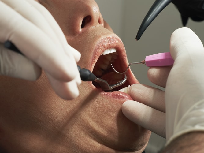 7 Steps to Prepare Yourself for a Dental Appointment