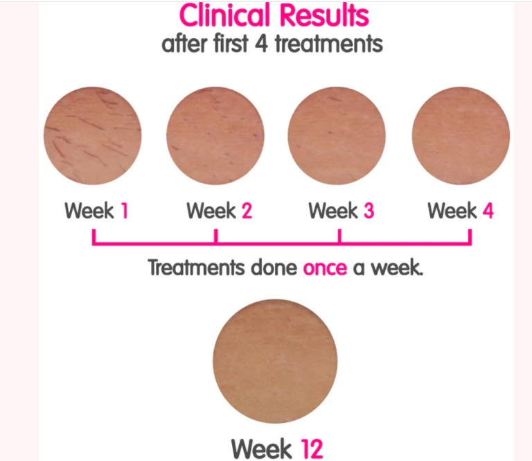 Lumi Hair Removal Device (Never Shave Again!) Shop With Me Mama