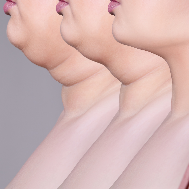 Do You Have A Double Chin? Read This!