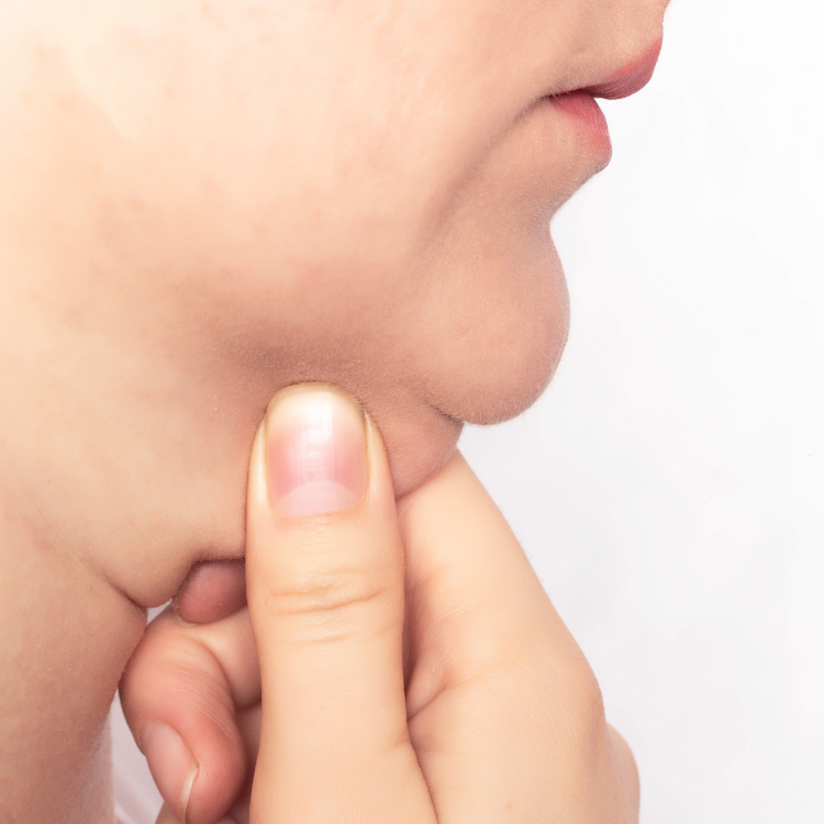 Do You Have A Double Chin? A Chin Liposuction Can Help!
