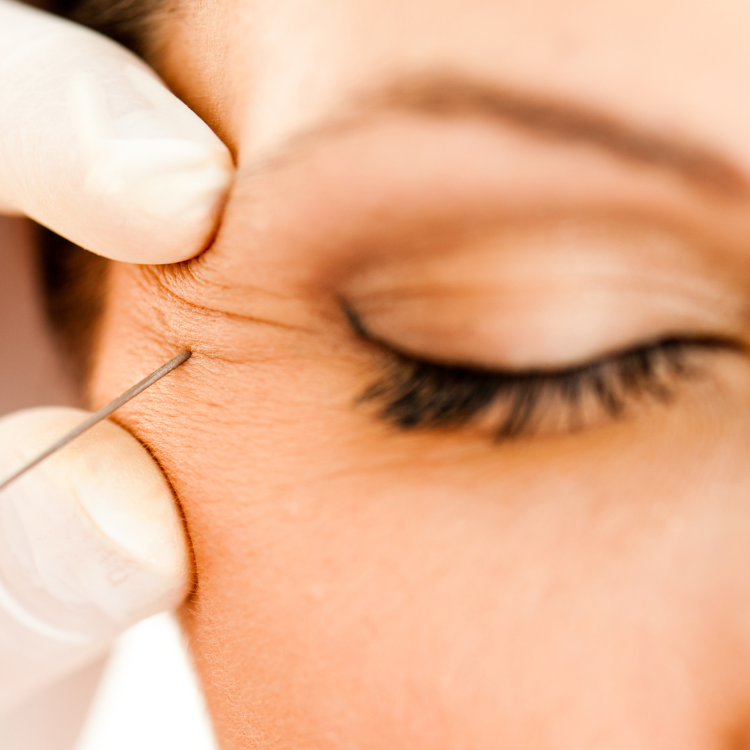 Your First Botox Treatment: What Everybody Should Know