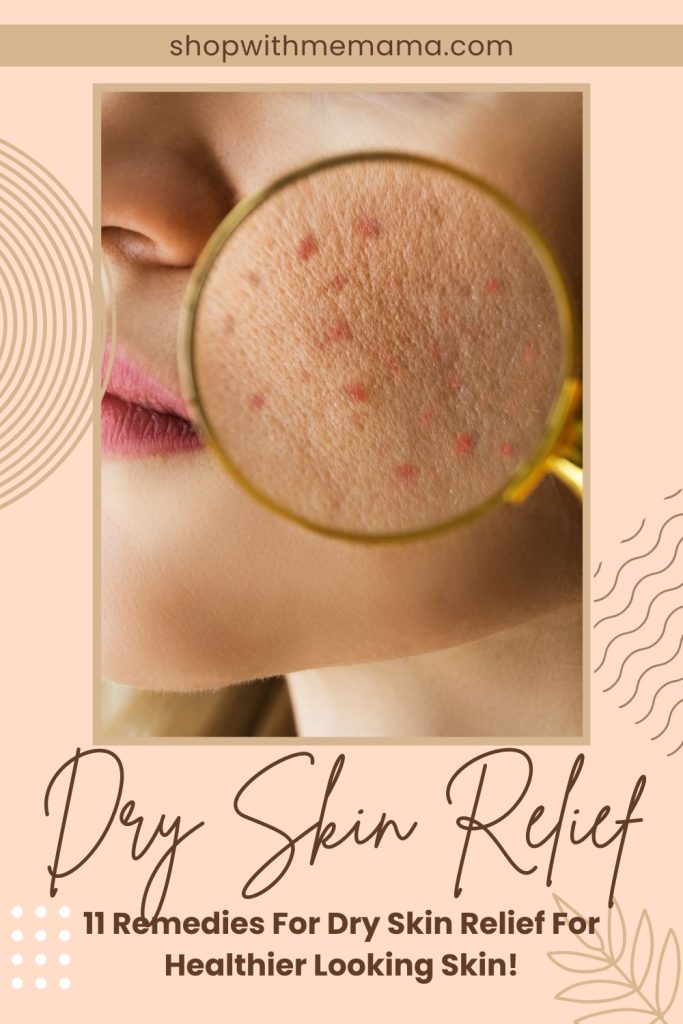 Remedies For Dry Skin Relief