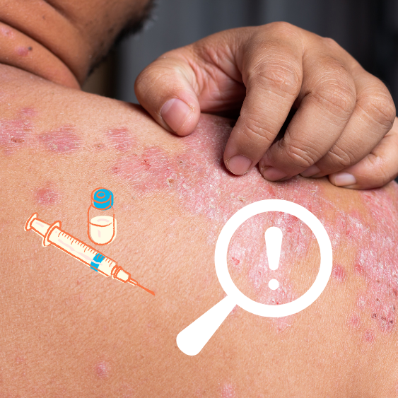 Instances When Medications Can Affect Your Skin And What To Do